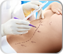 Cirurgia_Plástica_Cirurgia_Estética_Reparadora_Galante_Franco