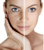 Tratamento_Dermatologia_Estética_Facial_Corpora_Ribeirão Preto Instituto Galante Franco - Dermatologia clínica
