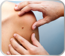 Tratamento_Dermatologia_Estética_Facial_Corpora_Ribeirão Preto Câncer de pele